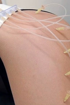 ozon-pic2