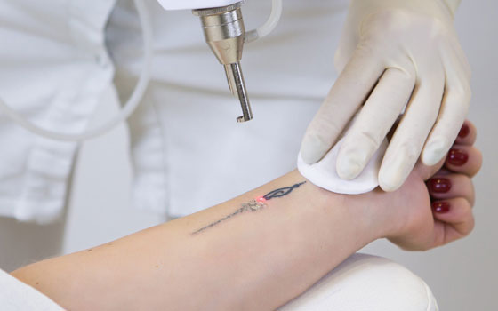 tatoo-pic1