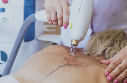 tatoo-pic3